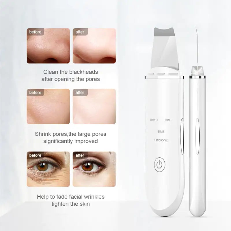 Ultrasonic Skin Scrubber Facial Cleaner