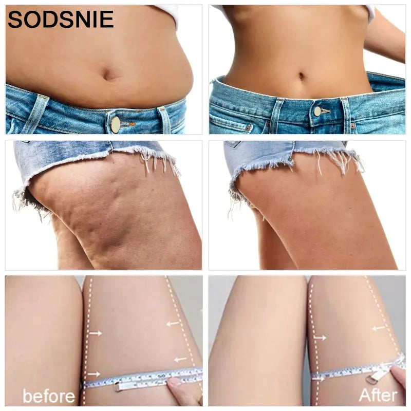 Slimming Cream Weight Loss Remove Cellulite Sculpting